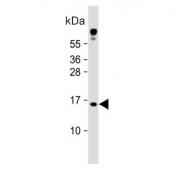 Western blot testing of human HeLa cell lysate with Tumor suppressor ARF antibody. Predicted molecular weight ~14 kDa.