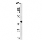 Western blot testing of human K562 cell lysate with ADE2 antibody. Predicted molecular weight ~47 kDa.