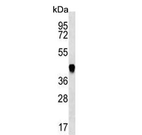 Western blot testing of mouse NIH 3T3 cell lysate with ADE2 antibody. Predicted molecular weight ~47 kDa.
