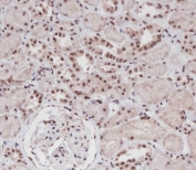 IHC testing of FFPE human kidney tissue with Single-minded homolog 1 antibody. HIER: steam section in pH6 citrate buffer for 20 min and allow to cool prior to staining.