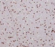 IHC testing of FFPE human brain tissue with Single-minded homolog 1 antibody. HIER: steam section in pH6 citrate buffer for 20 min and allow to cool prior to staining.