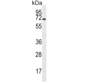 Western blot testing of human HL60 cell lysate with SLC6A14 antibody. Predicted molecular weight ~72 kDa.