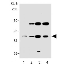 Western blot testing of human 1) lung, 2) HeLa, 3) HepG2 and 4) HACAT cell lysate with SLC6A14 antibody. Predicted molecular weight ~72 kDa.