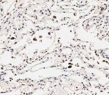 IHC testing of FFPE human lung tissue with SLC6A14 antibody. HIER: steam section in pH9 EDTA for 20 min and allow to cool prior to staining.