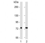Western blot testing of human 1) breast and 2) lung lysate with SLC6A14 antibody. Predicted molecular weight ~72 kDa.