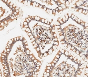 IHC testing of FFPE human small intestine tissue with ASAM antibody. HIER: steam section in pH9 EDTA for 20 min and allow to cool prior to staining.