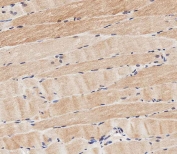 IHC testing of FFPE human skeletal muscle tissue with ASAM antibody. HIER: steam section in pH9 EDTA for 20 min and allow to cool prior to staining.