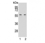 Western blot testing of human 1) K562 and 2) NCI-H292 cell lysate with MPP3 antibody. Predicted molecular weight ~66 kDa.