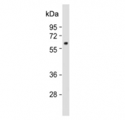 Western blot testing of human HepG2 cell lysate with MPP3 antibody. Predicted molecular weight ~66 kDa.