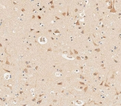 IHC testing of FFPE human brain tissue with Protocadherin 9 antibody. HIER: steam section in pH9 EDTA for 20 min and allow to cool prior to staining.