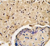 IHC testing of FFPE human placental tissue with HtrA3 antibody. HIER: steam section in pH6 citrate buffer for 20 min and allow to cool prior to staining.