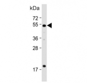 Western blot testing of human heart lysate with HtrA3 antibody. Predicted molecular weight ~49 kDa.