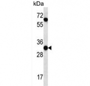 Western blot testing of human K562 cell lysate with PI15 antibody. Predicted molecular weight ~29 kDa.