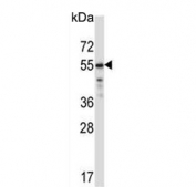 Western blot testing of human WiDr cell lysate with TFCP2L1 antibody. Predicted molecular weight ~55 kDa.