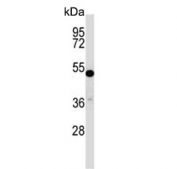 Western blot testing of mouse stomach tissue lysate with TFCP2L1 antibody. Predicted molecular weight ~55 kDa.