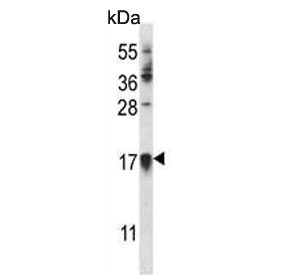Western blot testing of mouse Neuro-2a cell lysate with CDKN1A antibody. Expected molecular weight: 18-21 kDa.