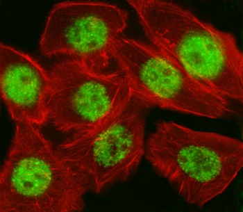 Immunofluorescent staining of fixed and permeabilized human A549 cells with CDKN1A antibody (green) and anti-Actin (red).