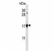 Western blot testing of human Jurkat cell lysate with CDKN1A antibody. Expected molecular weight: 18-21 kDa.