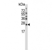 Western blot testing of human SK-BR-3 cell lysate with SDF2-like protein 1 antibody. Predicted molecular weight ~24 kDa.