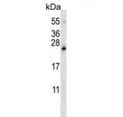 Western blot testing of mouse Neuro-2a cell lysate with SDF2-like protein 1 antibody. Predicted molecular weight ~24 kDa.