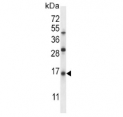 Western blot testing of human Jurkat cell lysate with Pulmonary surfactant-associated protein C antibody. Predicted molecular weight ~21 kDa.