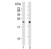 Western blot testing of human 1) lung and 2) K562 cell lysate with Pulmonary surfactant-associated protein C antibody. Predicted molecular weight ~21 kDa.