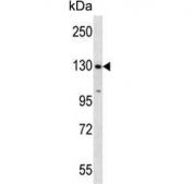 Western blot testing of human CCRF-CEM cell lysate with Splicing factor 3B subunit 1 antibody. Predicted molecular weight ~146 kDa.