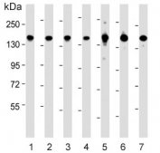 Western blot testing of 1) human PANC-1, 2) human HeLa, 3) human Jurkat, 4) mouse NIH 3T3, 5) human H-4-II-E, 6) human A431 and 7) human HepG2 cell lysate with Splicing factor 3B subunit 1 antibody. Predicted molecular weight ~146 kDa.