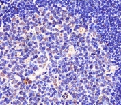 IHC testing of FFPE human tonsil tissue with Splicing factor 3B subunit 1 antibody. HIER: steam section in pH6 citrate buffer for 20 min and allow to cool prior to staining.