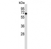 Western blot testing of human HeLa cell lysate with ALK2 antibody. Predicted molecular weight ~57 kDa.