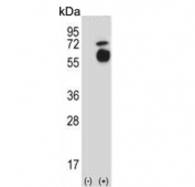Western blot testing of 1) non-transfected and 2) transfected 293 cell lysate with ALK2 antibody. Predicted molecular weight ~57 kDa.