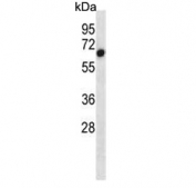 Western blot testing of mouse bladder tissue lysate with ALK2 antibody. Predicted molecular weight ~57 kDa.