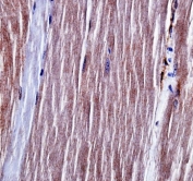 IHC testing of FFPE mouse skeletal muscle tissue with ALK2 antibody. HIER: steam section in pH6 citrate buffer for 20 min and allow to cool prior to staining.