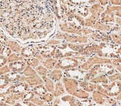 IHC testing of FFPE human kidney tissue with RAB1B antibody. HIER: steam section in pH9 EDTA for 20 min and allow to cool prior to staining.