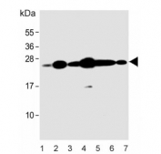Western blot testing of human 1) HEK293, 2) A549, 3) Hela, 4) T-47D, 5) U-87 MG, 6) mouse NIH 3T3 and 7) rat liver lysate with RAB1B antibody. Predicted molecular weight ~22 kDa.
