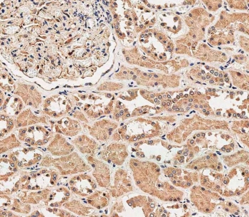 IHC testing of FFPE human kidney tissue with RAB1B antibody. HIER: steam section in pH9 EDTA for 20 min and allow to cool prior to staining.