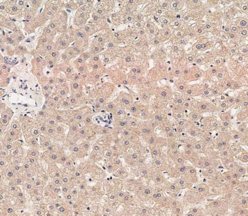 IHC testing of FFPE human liver tissue with RAB1B antibody. HIER: steam section in pH9 EDTA for 20 min and allow to cool prior to staining.