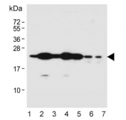 Western blot testing of human 1) HEK293, 2) A549, 3) Hela, 4) T-47D, 5) U-87 MG, 6) mouse liver and 7) rat liver lysate with RAB1B antibody. Predicted molecular weight ~22 kDa.