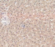 IHC testing of FFPE human liver tissue with RAB1B antibody. HIER: steam section in pH9 EDTA for 20 min and allow to cool prior to staining.