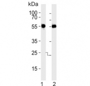 Western blot testing of mouse 1) kidney and 2) liver lysate with CKI-gamma 3 antibody. Predicted molecular weight ~49 kDa.