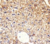 IHC testing of FFPE mouse liver tissue with CKI-gamma 3 antibody. HIER: steam section in pH6 citrate buffer for 20 min and allow to cool prior to staining.