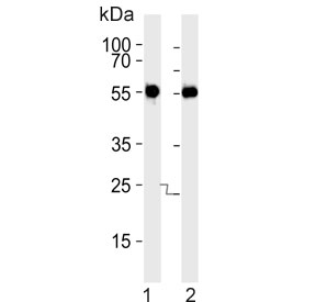 Western blot testing of mouse 1) kidney and 2) liver lysate with CKI-gamma 3 antibody. Predicted molecular weight ~49 kDa.