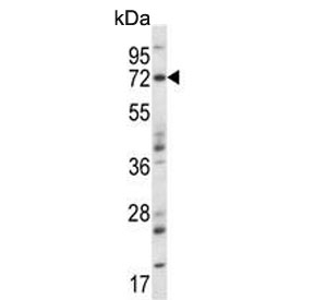 Western blot testing of mouse heart tissue lysate with Map3k7 antibody. Predicted molecular weight: 64-69 kDa, routinely observed at 78-82 kDa.