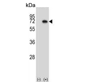 Western blot testing of 1) non-transfected and 2) transfected 293 cell lysate with Map3k7 antibody. Predicted molecular weight: 64-69 kDa, routinely observed at 78-82 kDa.