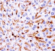 IHC testing of FFPE mouse liver tissue with IRF7 antibody. HIER: steam section in pH6 citrate buffer for 20 min and allow to cool prior to staining.