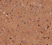 IHC testing of FFPE human brain tissue with TRPV1 antibody. HIER: steam section in pH6 citrate buffer for 20 min and allow to cool prior to staining.