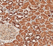 IHC testing of FFPE human kidney tissue with TRPV1 antibody. HIER: steam section in pH6 citrate buffer for 20 min and allow to cool prior to staining.