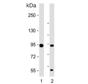Western blot testing of 1) mouse cerebellum and 2) rat cerebellum tissue lysate with TRPV1 antibody. Predicted molecular weight ~95 kDa.