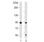 Western blot testing of 1) mouse cerebellum and 2) rat cerebellum tissue lysate with TRPV1 antibody. Predicted molecular weight ~95 kDa.