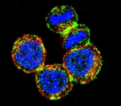 Immunofluorescent staining of human MDA-MB-435 cells with BIRC3 antibody (green), DAPI nuclear stain (blue) and anti-Actin (red).